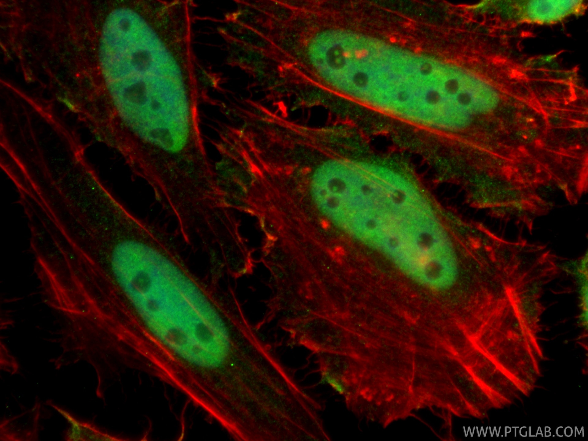 Immunofluorescence (IF) / fluorescent staining of HeLa cells using HRPT2, CDC73 Monoclonal antibody (66490-1-Ig)
