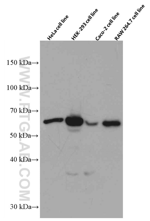 Western Blot (WB) analysis of various lysates using HRPT2, CDC73 Monoclonal antibody (66490-1-Ig)