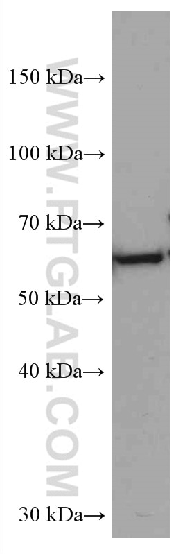 Western Blot (WB) analysis of pig brain tissue using HRPT2, CDC73 Monoclonal antibody (66490-1-Ig)