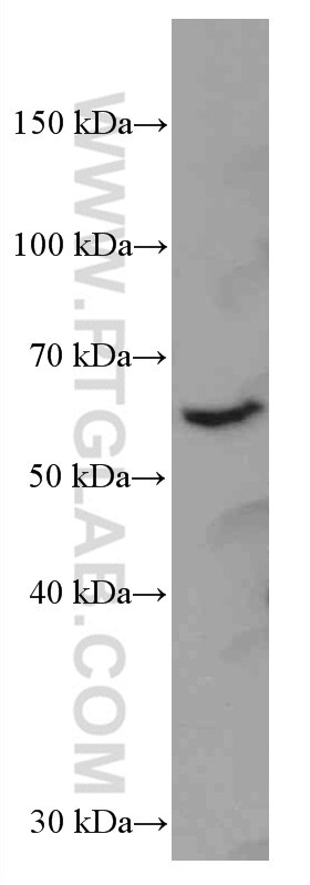 Western Blot (WB) analysis of mouse brain tissue using HRPT2, CDC73 Monoclonal antibody (66490-1-Ig)