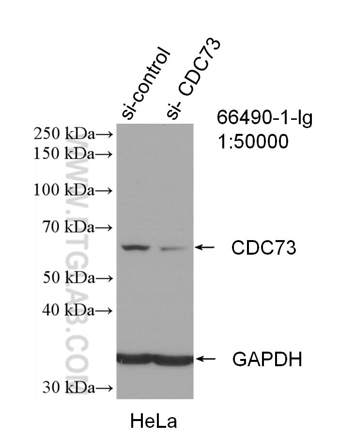 Western Blot (WB) analysis of HeLa cells using HRPT2, CDC73 Monoclonal antibody (66490-1-Ig)