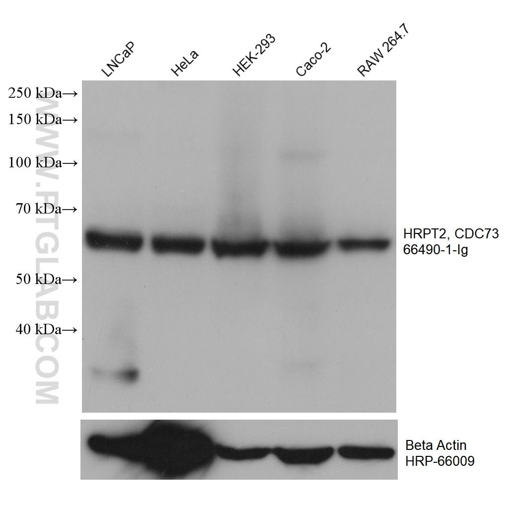 Western Blot (WB) analysis of various lysates using HRPT2, CDC73 Monoclonal antibody (66490-1-Ig)