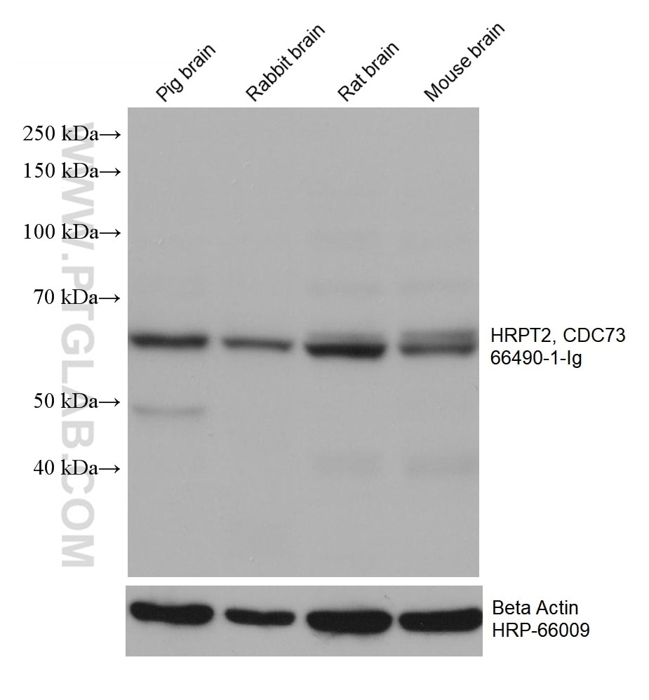 Western Blot (WB) analysis of various lysates using HRPT2, CDC73 Monoclonal antibody (66490-1-Ig)