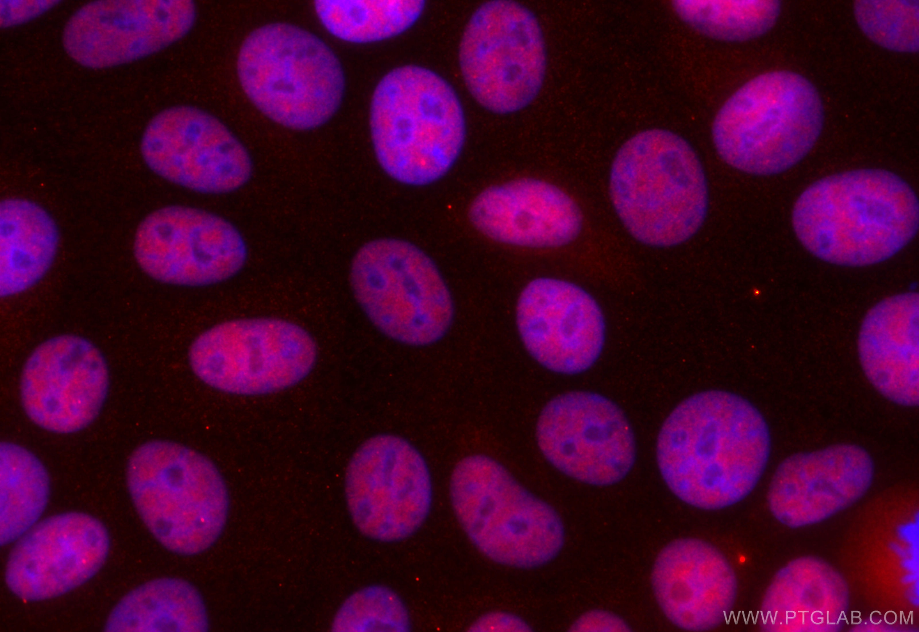 Immunofluorescence (IF) / fluorescent staining of MCF-7 cells using CoraLite®594-conjugated HRPT2, CDC73 Monoclonal an (CL594-66490)