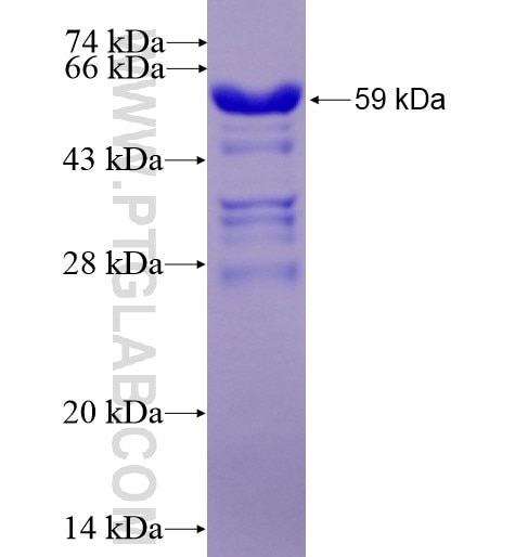 HRPT2; CDC73 fusion protein Ag2959 SDS-PAGE