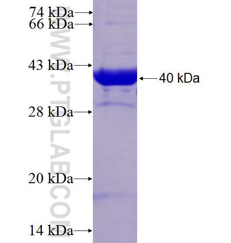 UK114; HRSP12 fusion protein Ag3628 SDS-PAGE