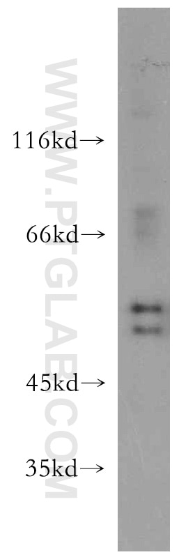 Western Blot (WB) analysis of HT-1080 cells using HS1BP3 Polyclonal antibody (12845-1-AP)