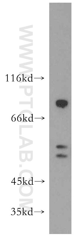 Western Blot (WB) analysis of Jurkat cells using HS1BP3 Polyclonal antibody (12845-1-AP)
