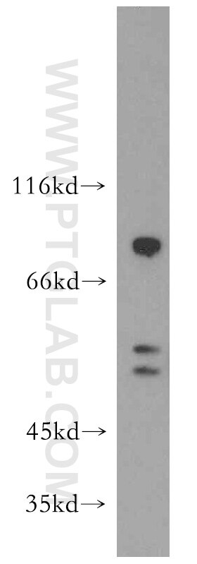 WB analysis of Jurkat using 12845-1-AP