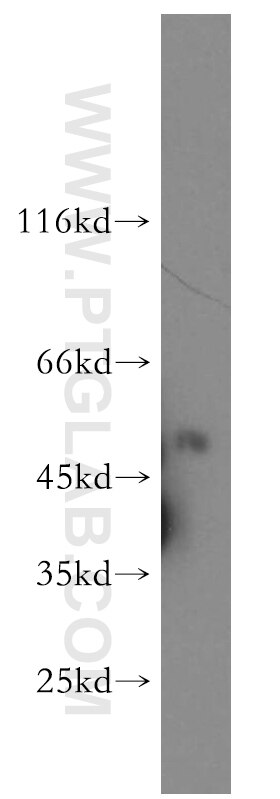 Western Blot (WB) analysis of HeLa cells using HS1BP3 Polyclonal antibody (12845-1-AP)