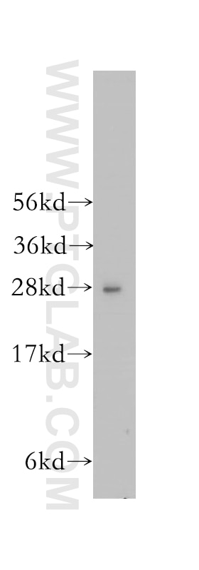 Western Blot (WB) analysis of human brain tissue using HS2ST1 Polyclonal antibody (12453-1-AP)