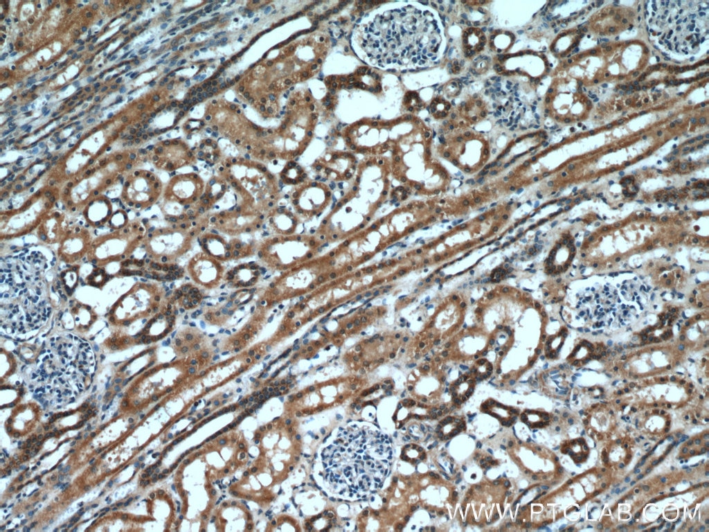 Immunohistochemistry (IHC) staining of human kidney tissue using HS3ST1 Polyclonal antibody (14358-1-AP)