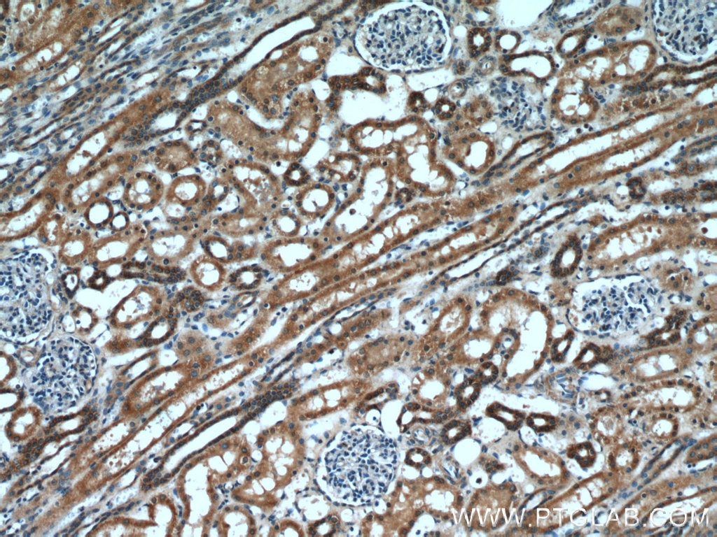 IHC staining of human kidney using 14358-1-AP