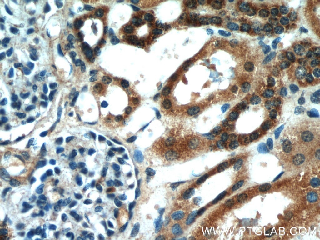 Immunohistochemistry (IHC) staining of human kidney tissue using HS3ST1 Polyclonal antibody (14358-1-AP)