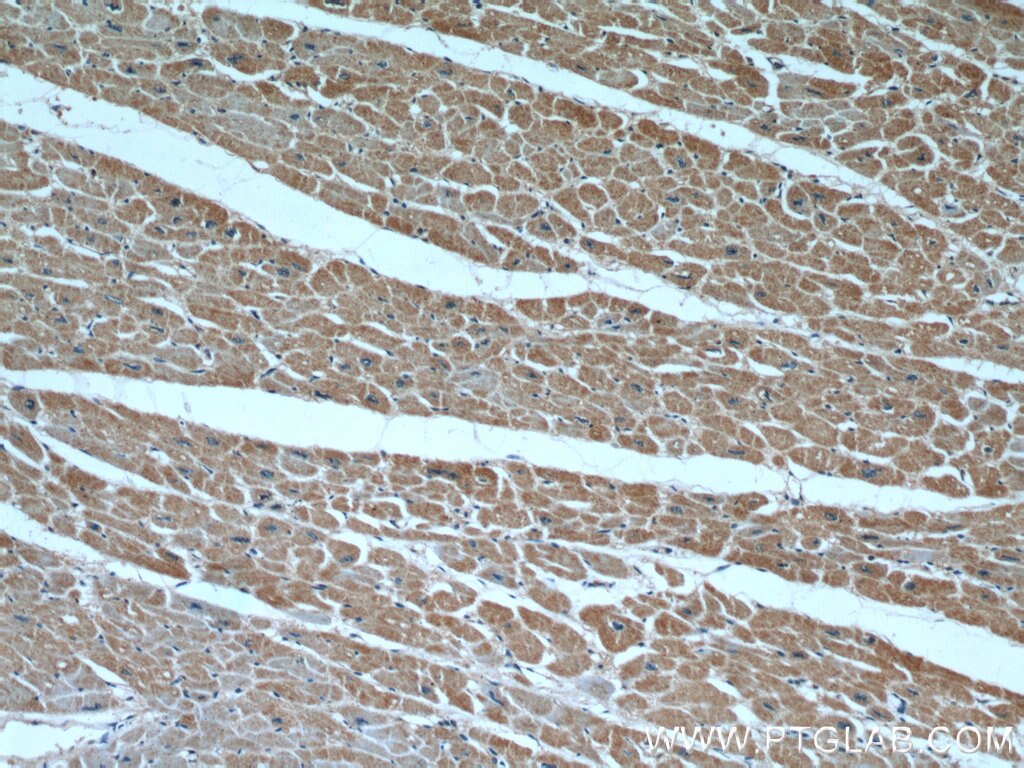 Immunohistochemistry (IHC) staining of human heart tissue using HS3ST1 Polyclonal antibody (14358-1-AP)