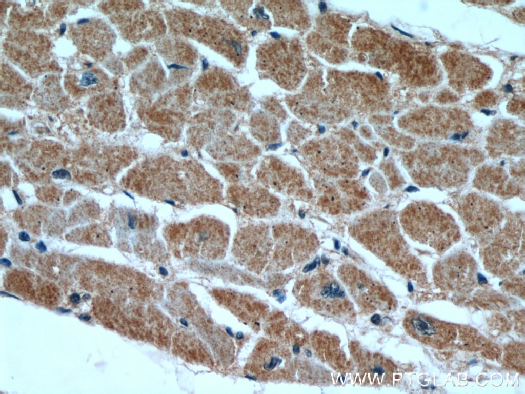 Immunohistochemistry (IHC) staining of human heart tissue using HS3ST1 Polyclonal antibody (14358-1-AP)