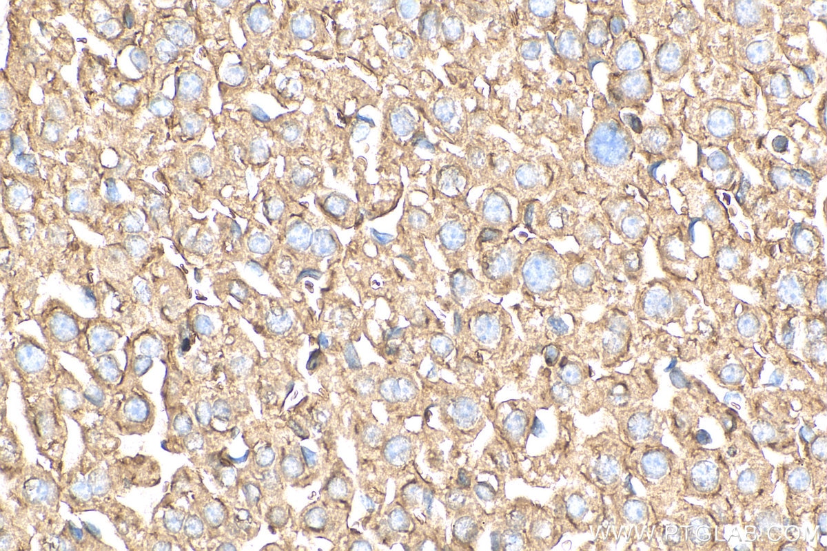 Immunohistochemistry (IHC) staining of mouse liver tissue using HSBP1 Polyclonal antibody (10169-2-AP)