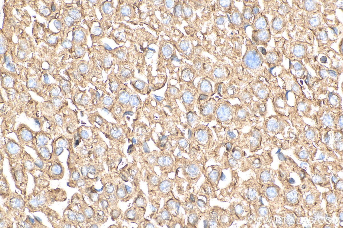 IHC staining of mouse liver using 10169-2-AP