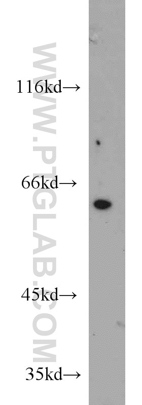 WB analysis of mouse brain using 10169-2-AP