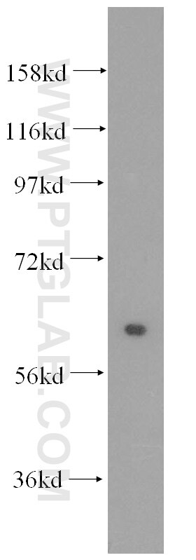 Western Blot (WB) analysis of human brain tissue using HSBP1 Polyclonal antibody (10169-2-AP)