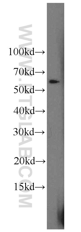 Western Blot (WB) analysis of mouse brain tissue using HSBP1 Polyclonal antibody (10169-2-AP)