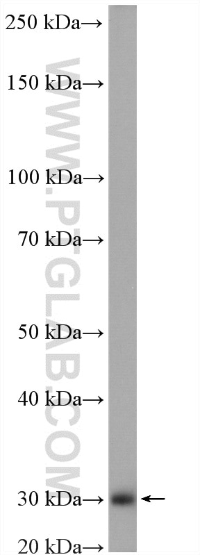 Western Blot (WB) analysis of rat liver tissue using HSCB Polyclonal antibody (15132-1-AP)