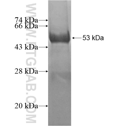 HSCB fusion protein Ag13897 SDS-PAGE