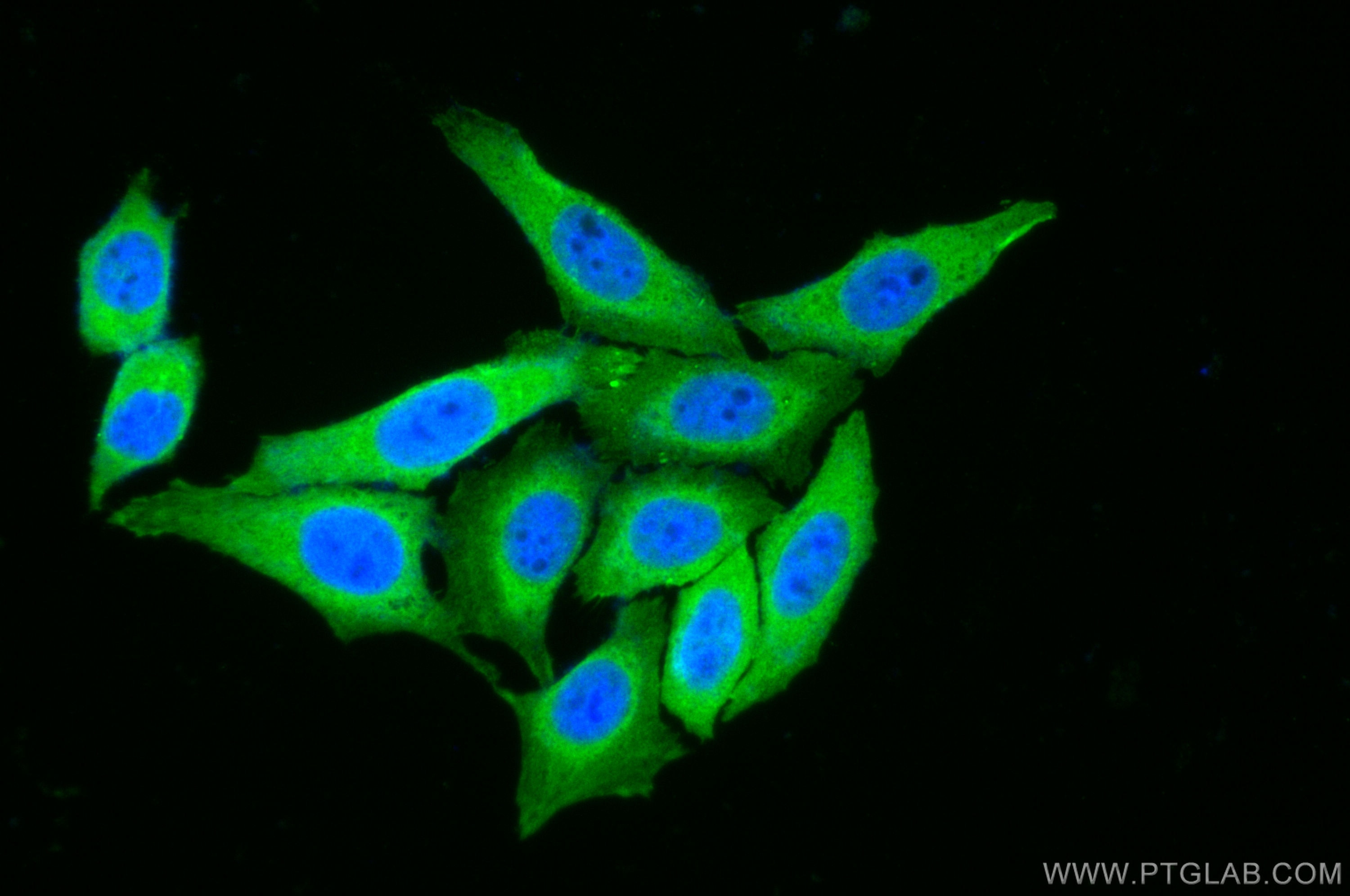 Immunofluorescence (IF) / fluorescent staining of HepG2 cells using HSD11B1 Polyclonal antibody (10928-1-AP)
