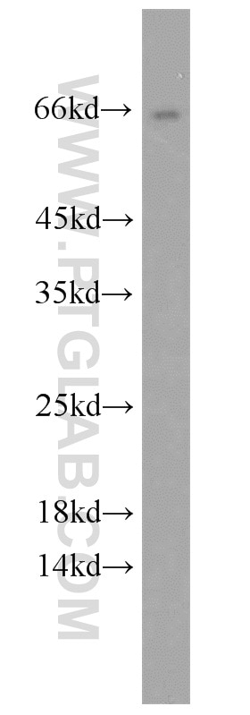 Western Blot (WB) analysis of mouse liver tissue using HSD11B1 Polyclonal antibody (10928-1-AP)