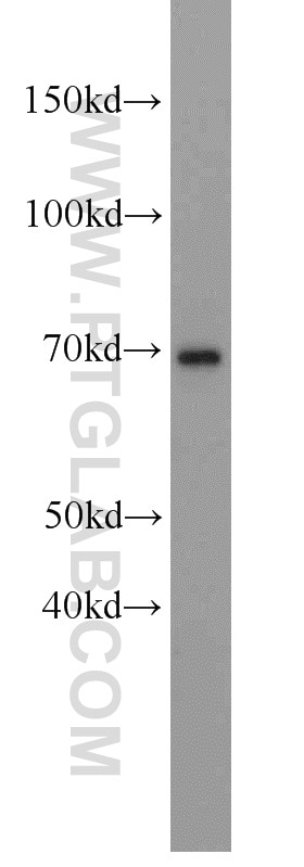 Western Blot (WB) analysis of L02 cells using HSD11B1 Polyclonal antibody (10928-1-AP)