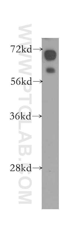 Western Blot (WB) analysis of Jurkat cells using HSD11B1 Polyclonal antibody (10928-1-AP)