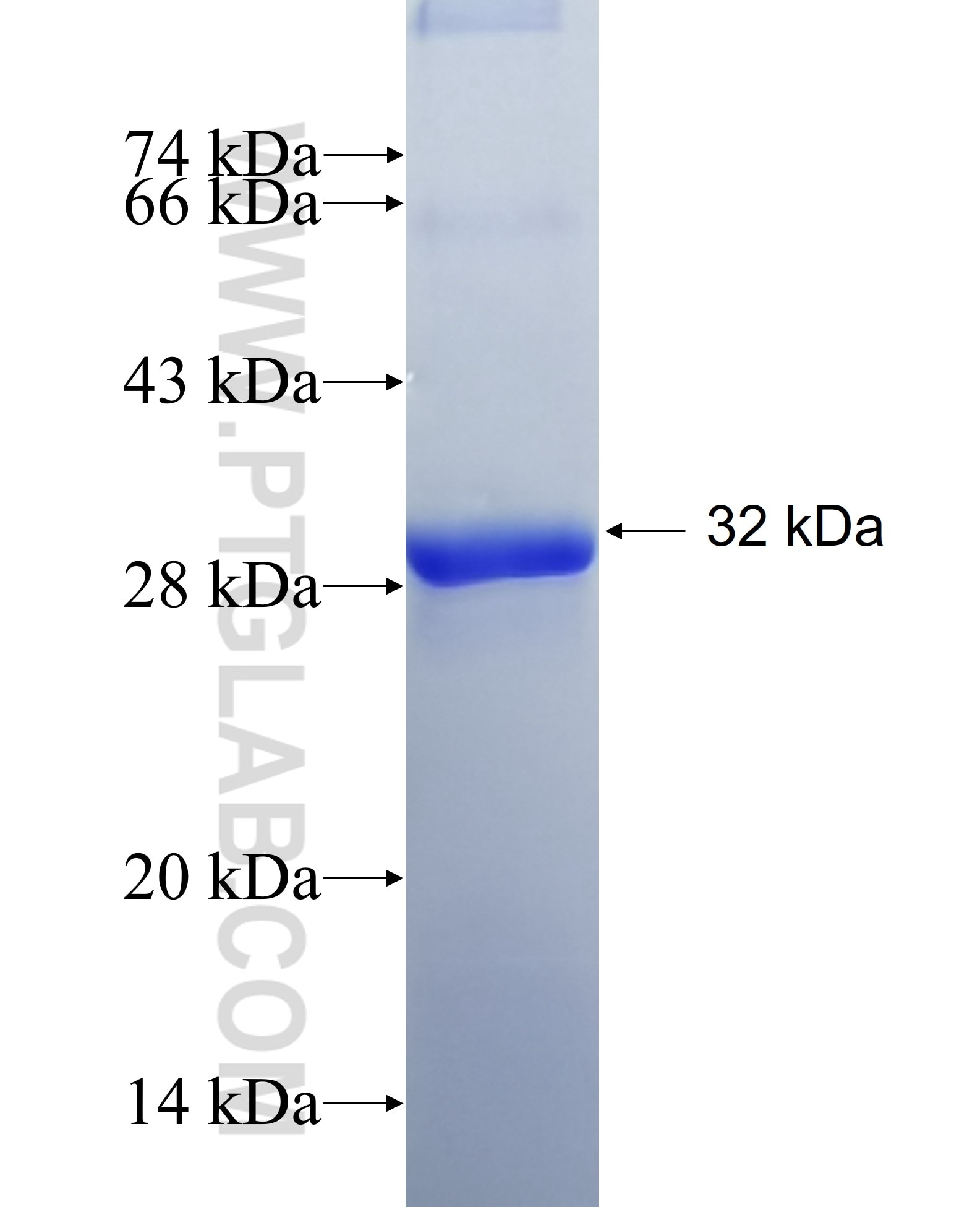 HSD11B1 fusion protein Ag29494 SDS-PAGE