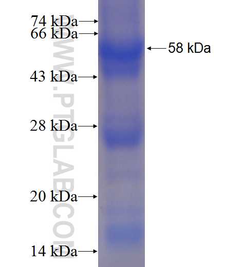 HSD11B1 fusion protein Ag1361 SDS-PAGE