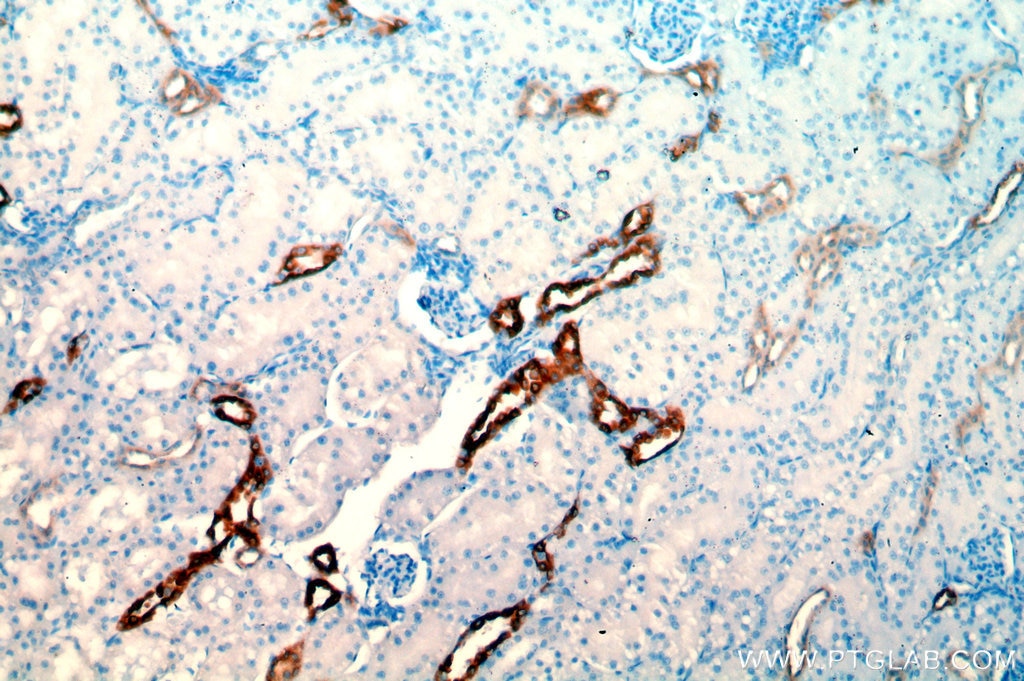 Immunohistochemistry (IHC) staining of human kidney tissue using HSD11B2 Polyclonal antibody (14192-1-AP)