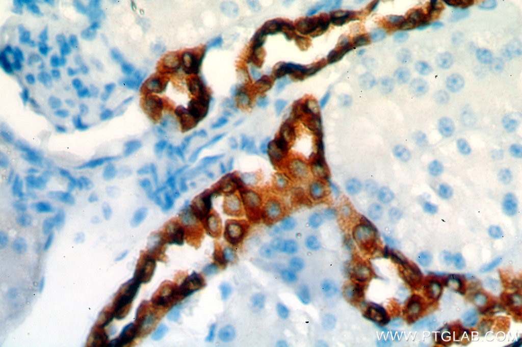 Immunohistochemistry (IHC) staining of human kidney tissue using HSD11B2 Polyclonal antibody (14192-1-AP)