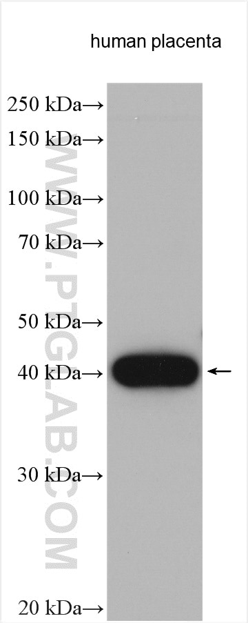 Western Blot (WB) analysis of various lysates using HSD11B2 Polyclonal antibody (14192-1-AP)
