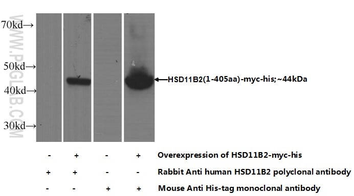 WB analysis of Transfected HEK-293 using 14192-1-AP