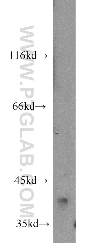 Western Blot (WB) analysis of mouse kidney tissue using HSD11B2 Polyclonal antibody (14192-1-AP)