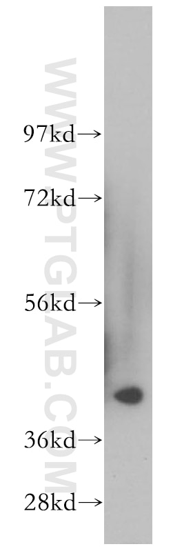 Western Blot (WB) analysis of human kidney tissue using HSD11B2 Polyclonal antibody (14192-1-AP)