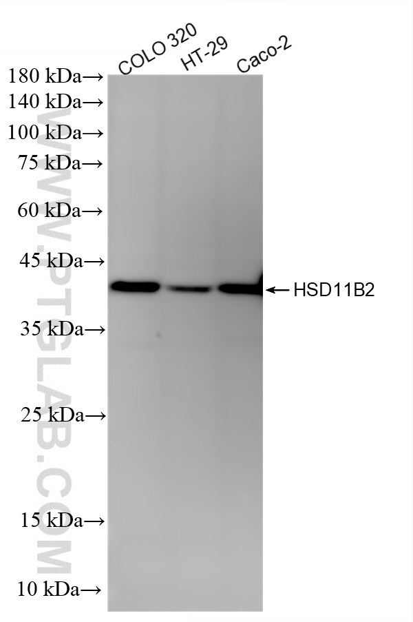 WB analysis using 87244-1-RR (same clone as 87244-1-PBS) Western Blot (WB) analysis of various lysates using HSD11B2 Recombinant monoclonal antibody (87244-1-RR)