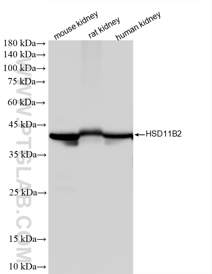 WB analysis using 87244-1-RR (same clone as 87244-1-PBS) Western Blot (WB) analysis of various lysates using HSD11B2 Recombinant monoclonal antibody (87244-1-RR)