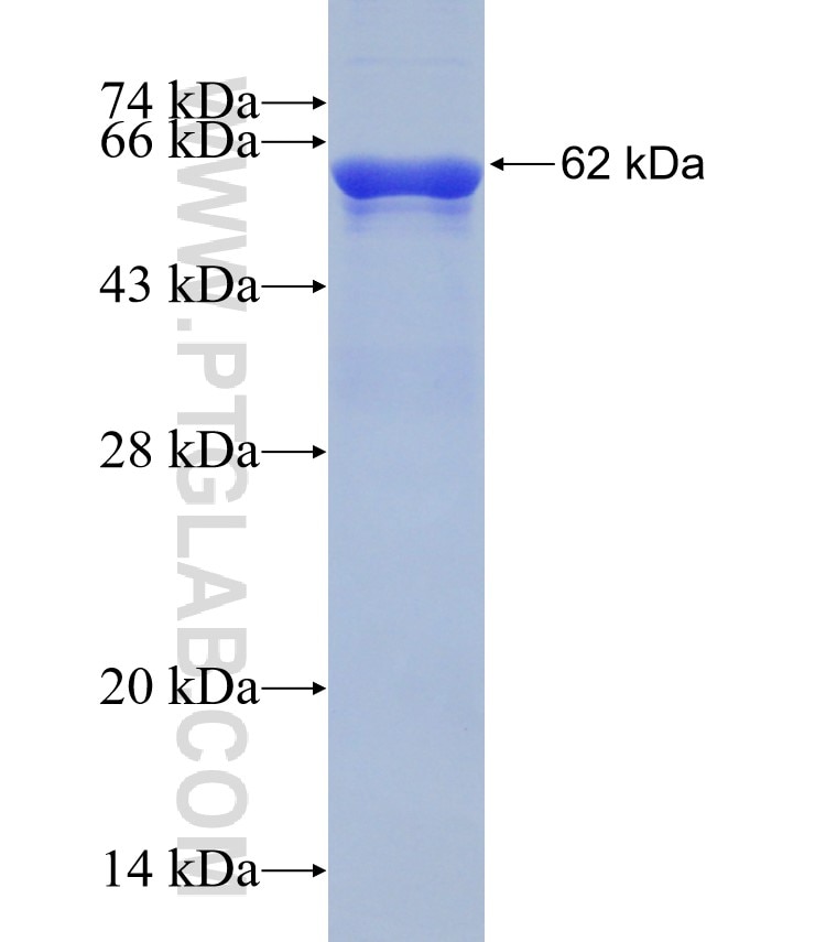 HSD11B2 fusion protein Ag5146 SDS-PAGE