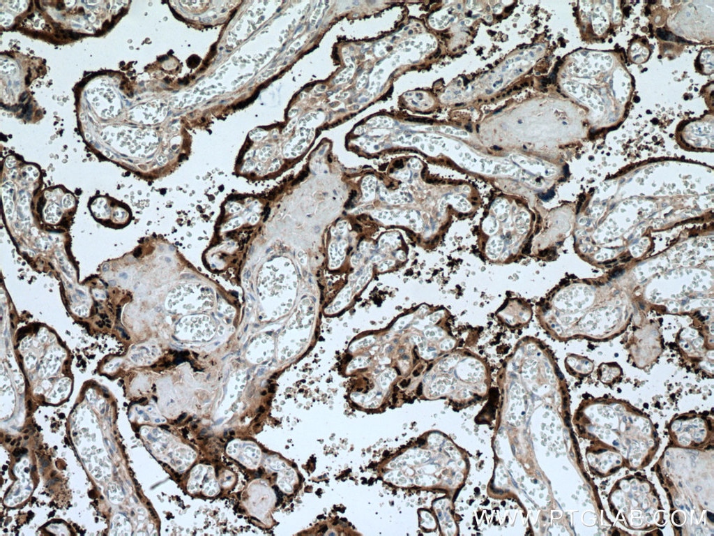 Immunohistochemistry (IHC) staining of human placenta tissue using HSD17B1 Polyclonal antibody (25334-1-AP)