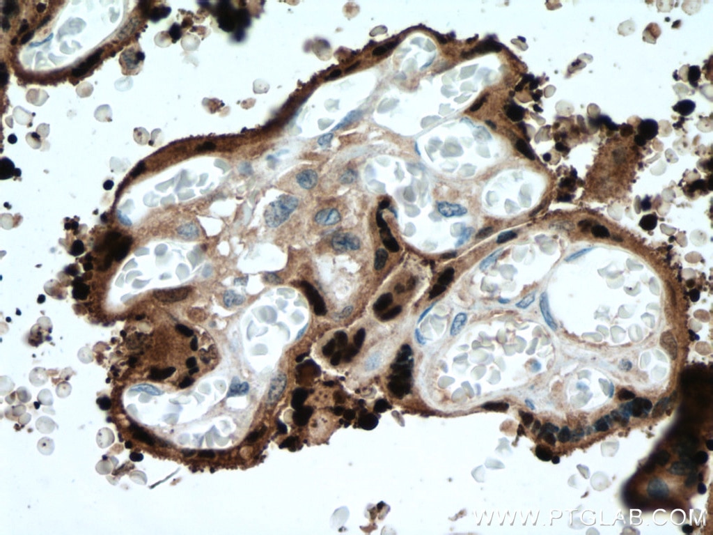Immunohistochemistry (IHC) staining of human placenta tissue using HSD17B1 Polyclonal antibody (25334-1-AP)
