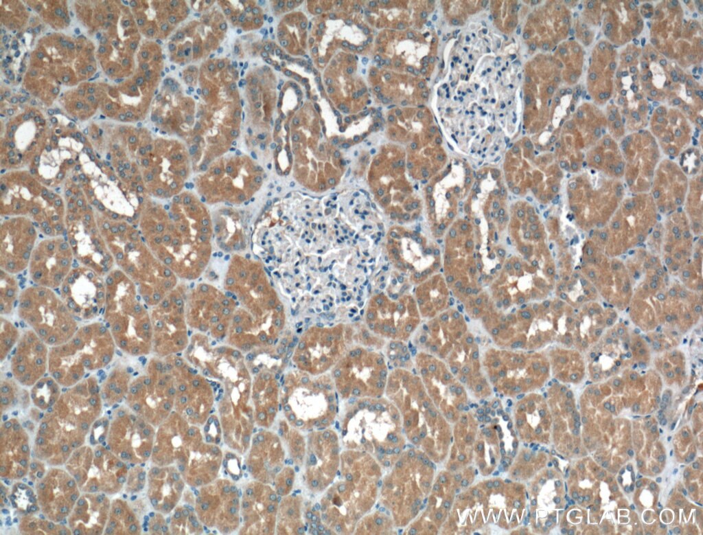 Immunohistochemistry (IHC) staining of human kidney tissue using HSD17B1 Polyclonal antibody (25334-1-AP)