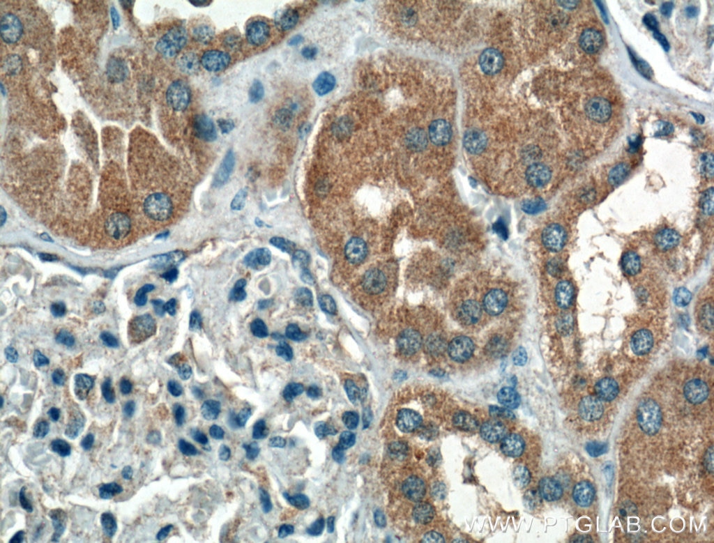 Immunohistochemistry (IHC) staining of human kidney tissue using HSD17B1 Polyclonal antibody (25334-1-AP)