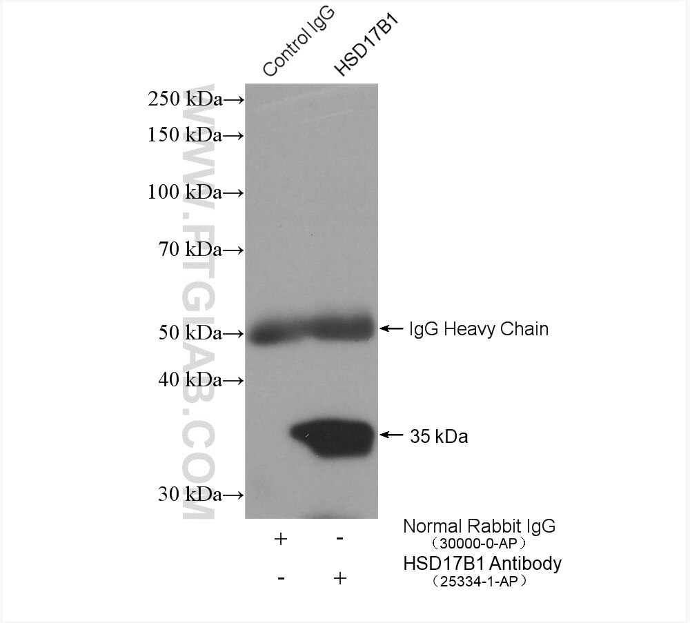 Immunoprecipitation (IP) experiment of human placenta tissue using HSD17B1 Polyclonal antibody (25334-1-AP)