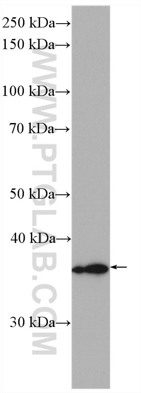 WB analysis of human placenta using 25334-1-AP