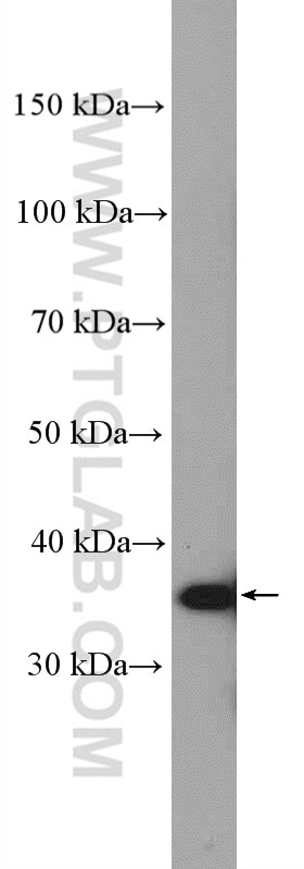 Western Blot (WB) analysis of human placenta tissue using HSD17B1 Polyclonal antibody (25334-1-AP)