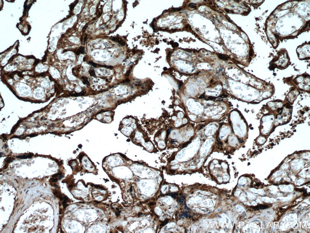 IHC staining of human placenta using 27830-1-AP